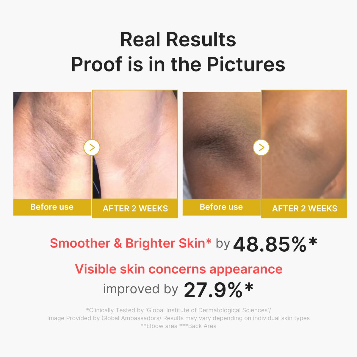 Kojic Acid and Turmeric Brightening Body Peel Treatment