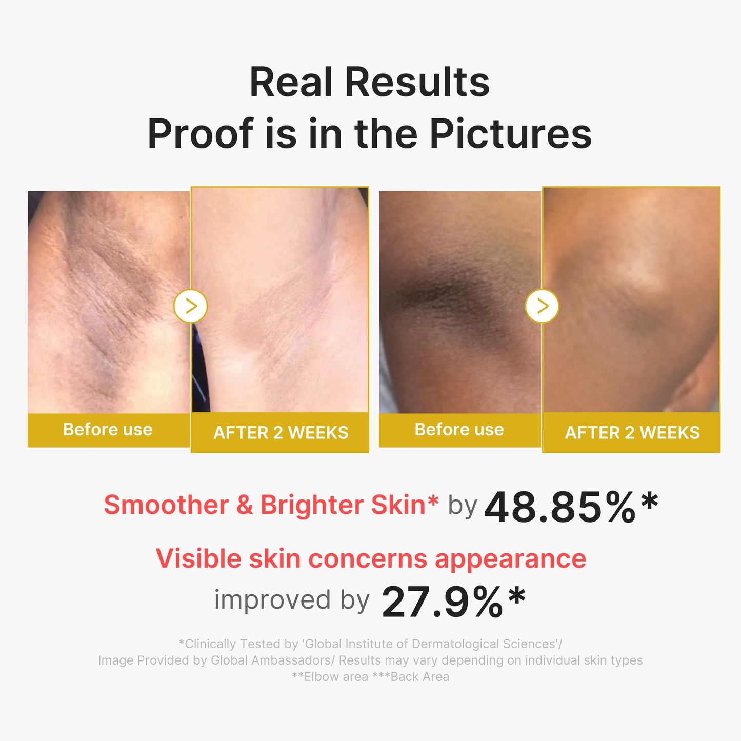 Kojic Acid and Turmeric Brightening Body Peel Treatment