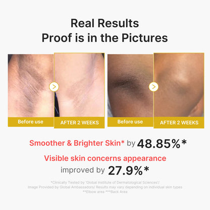 Kojic Acid and Turmeric Brightening Body Peel Treatment