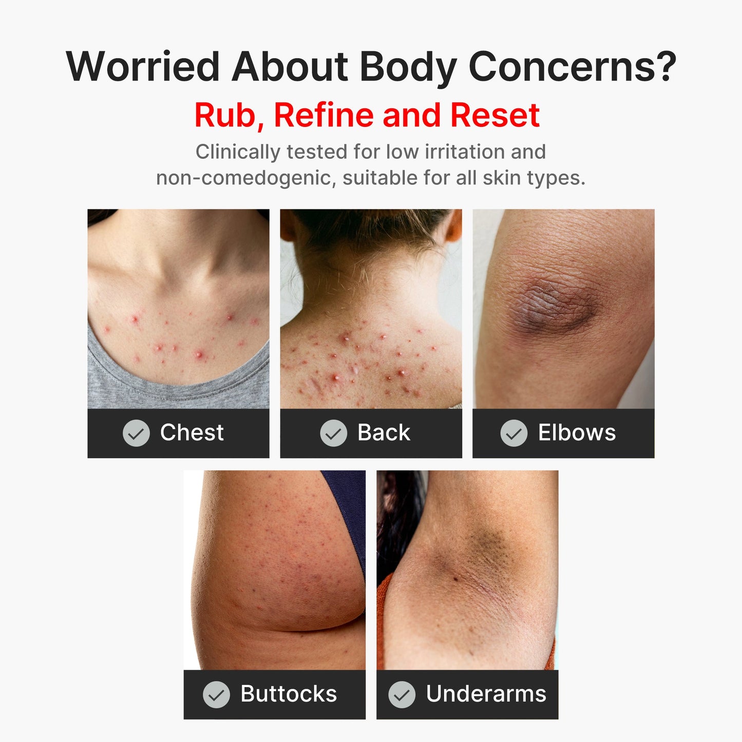 Kojic Acid and Turmeric Brightening Body Peel Treatment