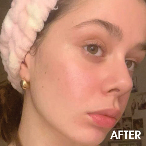 Renewal & Rejuvenation Exfoliating Facial Toner Pads