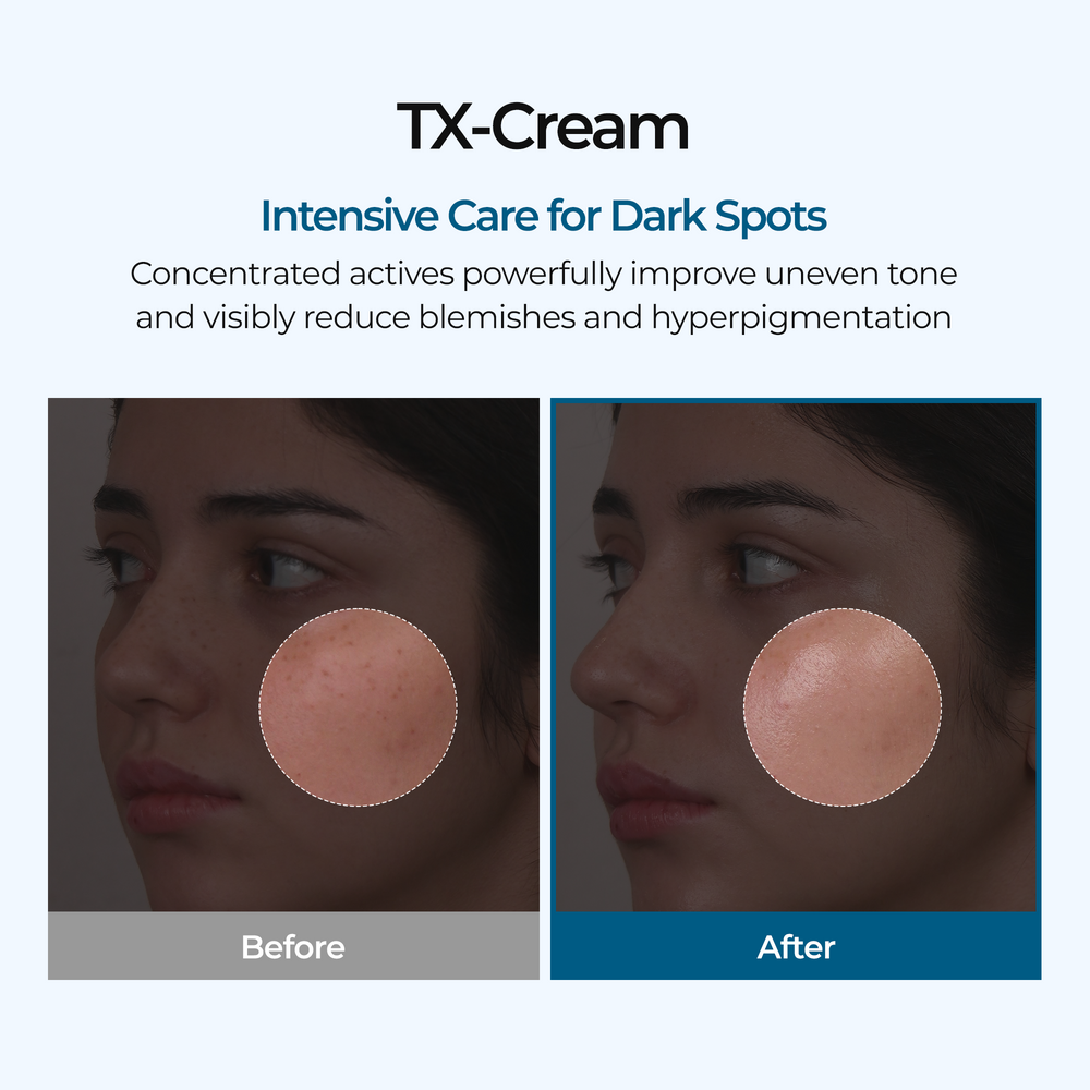 TX Cream